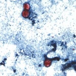 How to stay safe and still enjoy produce this summer with the outbreak of diarrhea-causing parasite