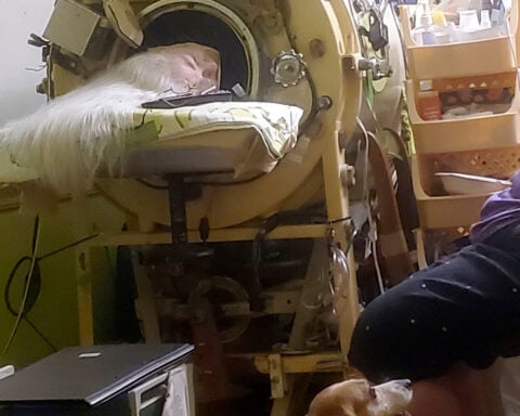 Martha Lillard, last US polio patient using iron lung, dies at 78 in Oklahoma