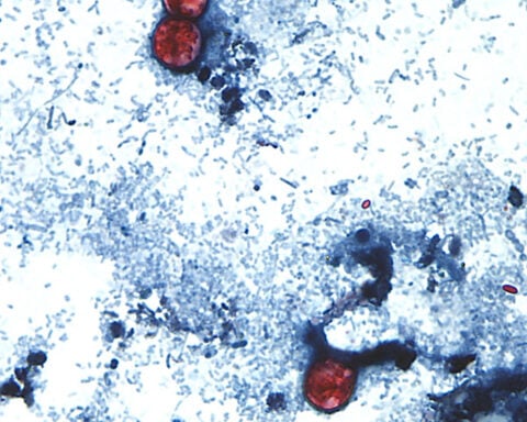 As cyclospora illnesses surge to a record, Michigan officials eye lettuce as a possible cause