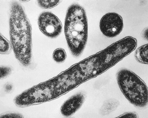 Dozens of New York cooling towers test positive for Legionnaires’ bacteria as outbreak reaches 63 cases
