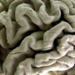 Study shows a blood test can help identify healthy people at high risk for Alzheimer's disease