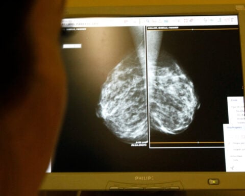 Celcuity shares fall as launch delay eclipses US approval for breast cancer drug