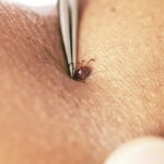 How to avoid tick bites in your yard or while hiking in the woods, and what to do if one starts feasting on you