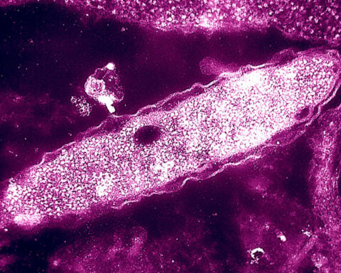 One death reported in New York City Legionnaires’ disease cluster