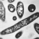 Second death reported in Legionnaires’ disease outbreak in New York City