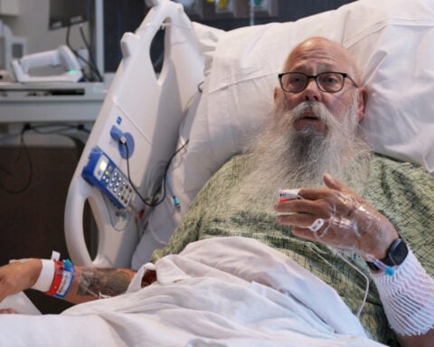 Man tossed by Yellowstone bison says hitting the ground was the worst part