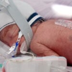 After an extremely rare pregnancy, an Australian woman gives birth to identical quadruplet girls