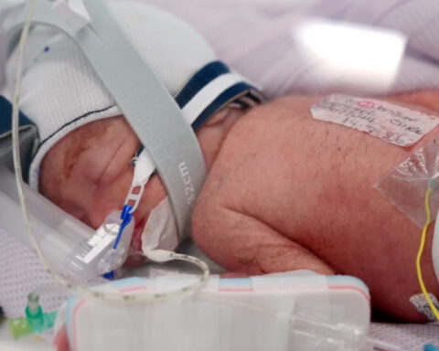An Australian woman gives birth to rare identical quadruplet girls