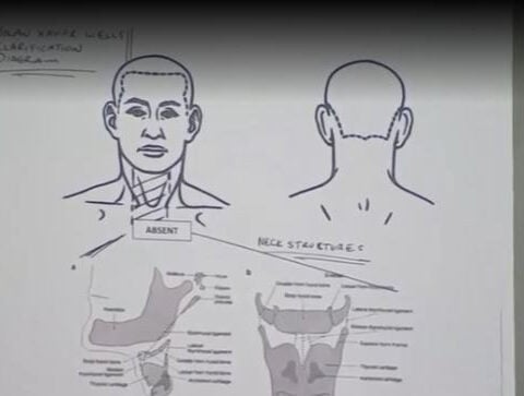 New questions emerge after second autopsy in Nolan Wells' death