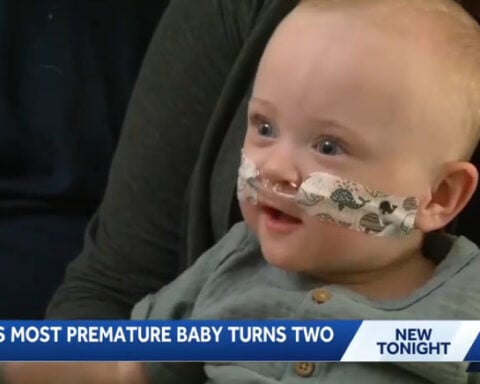 Iowa toddler recognized as world’s most premature baby celebrates second birthday