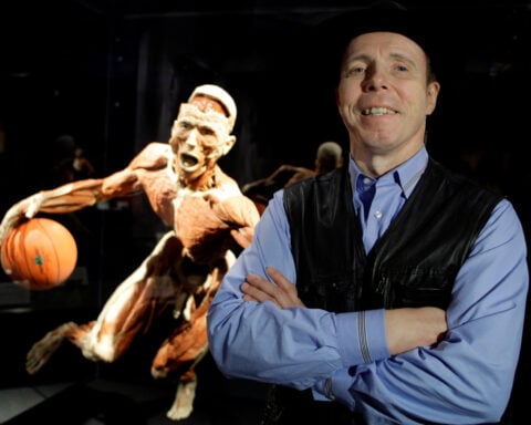 Gunther von Hagens, the German anatomist behind the 'Body Worlds' exhibition, dies at 81