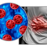 Cyclosporiasis sickens some people worse – why your diarrhea could be more explosive than others