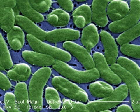 Flesh-eating bacteria are devouring limbs in warming waters worldwide − here’s how to protect yourself