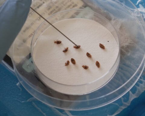 Bedbugs can cause people to lose sleep — and blood. Here's what to do about them