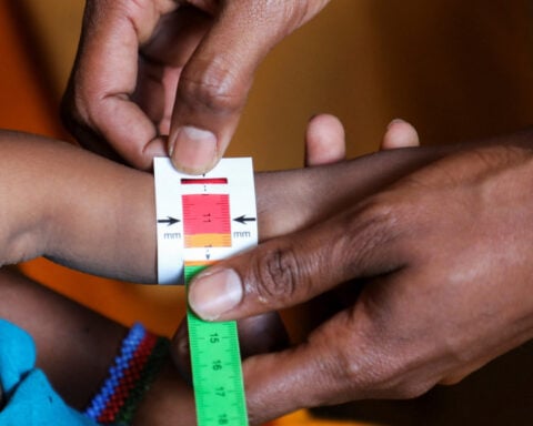 Somali child hunger crisis deepens as facilities close due to aid cuts, UNICEF says