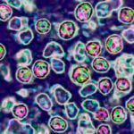 Two people in Pennsylvania have died from measles