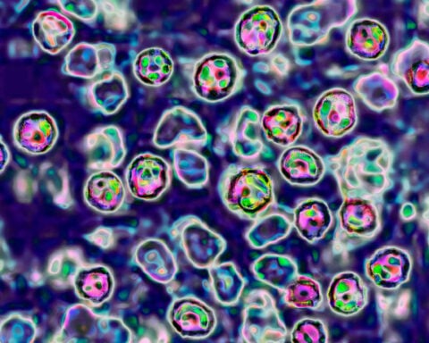 Two people in Pennsylvania have died from measles