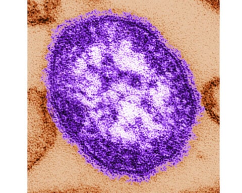 Pennsylvania reports first 2 measles deaths in the US this year, both people unvaccinated