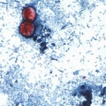 US officials tie cyclospora outbreak involving iceberg lettuce to 3 more states