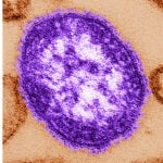 Measles deaths reported in Pennsylvania spark fight among politicians and health officials