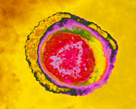 Shingles can cause severe chronic pain – new research on how exosomes alter neurons offers pathways to treatment