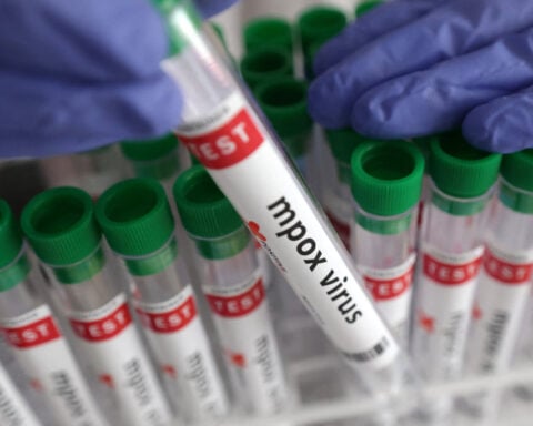 Mpox case confirmed in northeastern Congolese city at center of Ebola outbreak