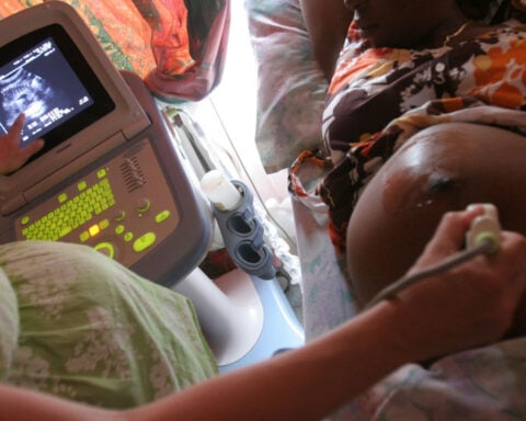 The Trump administration said it would prioritize ending mother-to-child HIV transmission. Health workers say it cut services