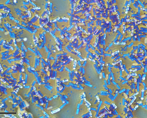 Hibernating bacteria can invade hospitals and survive outer space – but their high energy bill is a weakness that scientists can strike