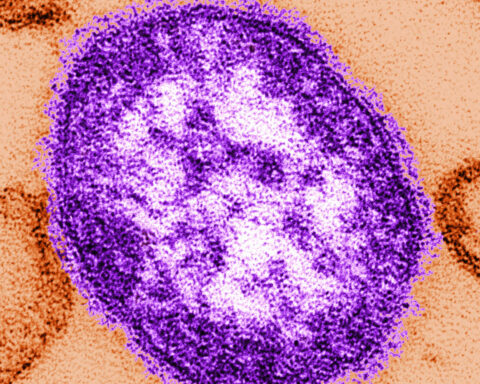 Pennsylvania tallies a fifth death related to measles as outbreak approaches a thousand cases