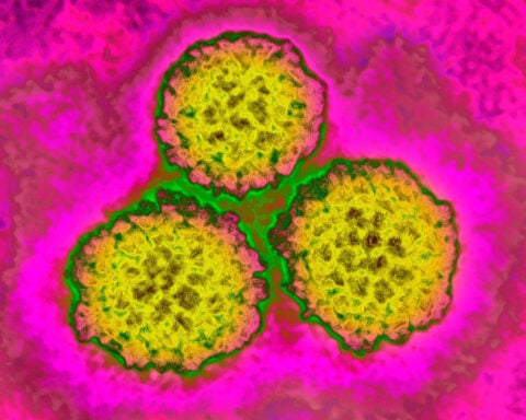 About 1 in 8 cancer cases worldwide are tied to these infections — most of them preventable