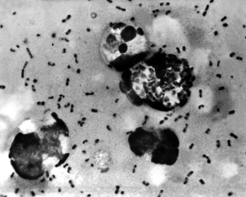 Pneumonic plague, by the numbers