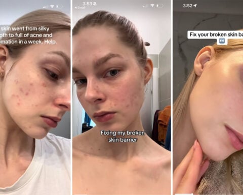 The ‘glass skin’ Korean beauty trend has risks, experts warn