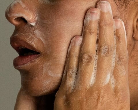 Adult acne is real, but there are ways to treat it. Here's what to know
