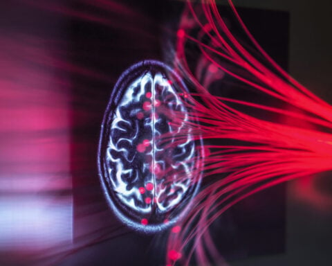 Using light to control brain cells – neuroscientist Karl Deisseroth explains how he made his Nobel-winning discovery