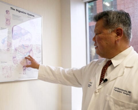 How the US organ transplant system works and what to ask to improve your chances