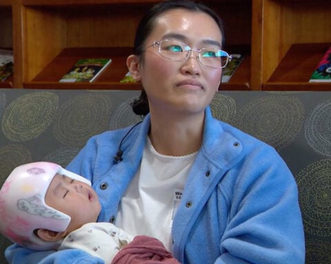 Baby who had 50 seizures a day now seizure-free after surgery at Children's Minnesota