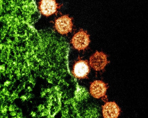 Viruses obey the laws of physics – studying how can help researchers understand why they infect people differently and lead to better treatments