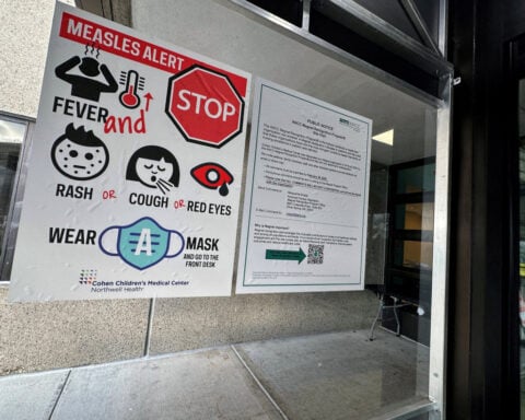 US measles cases rise to 4,852, CDC says
